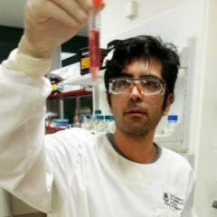  Protein to control breast cancer progression identified