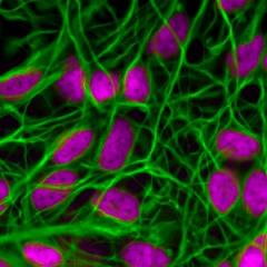 US Defense supports UQ breast cancer research