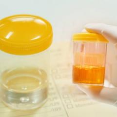 donate your urine to science