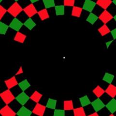 Hallucinations associated with brain hyperactivity in people with a common form of age-related blindness